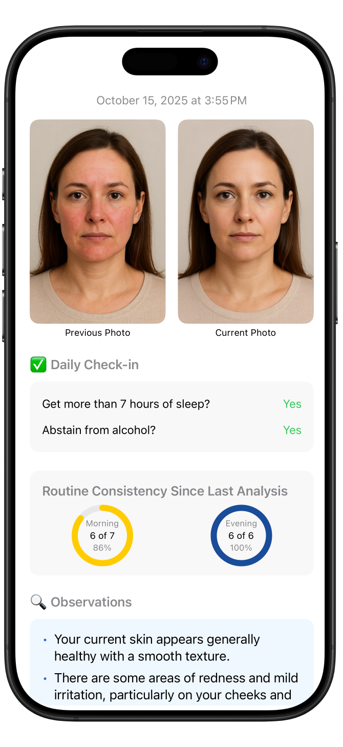 Progress Tracking and Analysis